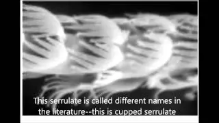 Setal Description Confusion