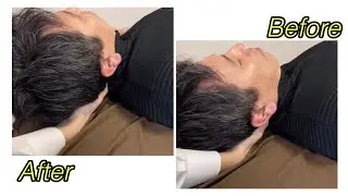 Membrane technique for stiff neck