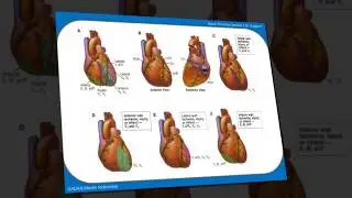 BTCLS | ACUTE CARONARY SYNDROME | PART 1