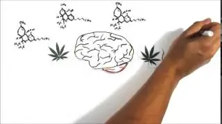 Мозг и ТНС