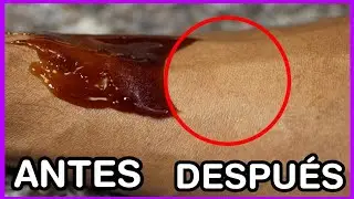 NUNCA FUE TAN FÁCIL ELIMINAR EL VELLO FACIAL O EN BRAZOS Y PIERNAS - Zara Martinez