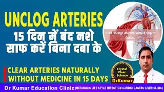 UNCLOG ARTERIES 15 दिन में बंद नशे साफ करें बिना दबा के//Clear arteries naturally  without medicine