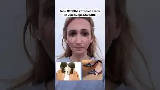 Почему стопы «растут» во время беременности?