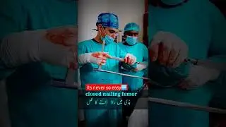 orthopedics || arthroscopy || sports surgery || femur surgery