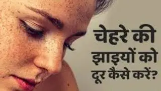 चेहरे पे झाइयां वापस क्यों वापस आ जाती है | elocon use | Pigmentation | melasma | Skin | Beauty