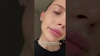 Не верьте, оно само по себе не пройдет! Читайте описание