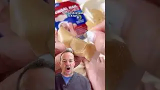 Doctor Reacts: Fungal Nail Patches!? 🤔