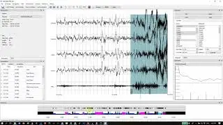 How to use wonambi to score/QC sleep data