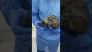 Anatomía externa basica del higado