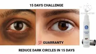 The Moms co under eye cream honest review 👍|| Reduce Dark circles in 15 Days #darkcircles #skincare