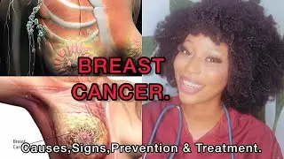 What causes *BREAST CANCER* in men & women//PREVENTION & TREATMENTS🩺.