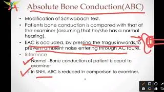 Absolute Bone Conduction Test (ABC) | Tuning Fork Test | ENT
