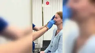 Відгук з ринопластики