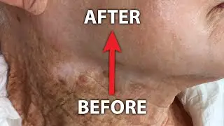 Shockingly Good Anti-Wrinkle Cream (not sponsored)