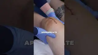 How to recover after knee surgery? 