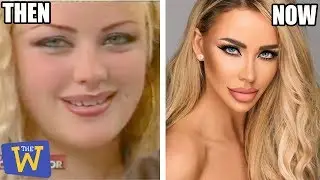 10 People Who Turned Themselves Into Plastic