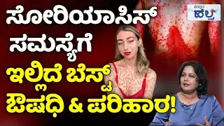Psoriasis Treatment In Kannada | Skin Care | ಸೋರಿಯಾಸಿಸ್ ಸಮಸ್ಯೆ ಕಾಡೋದಕ್ಕೆ ಮುಖ್ಯ ಕಾರಣವೇನು?