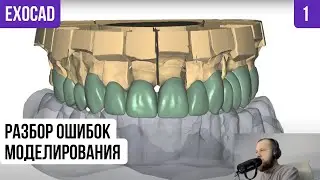 EXOCAD разбор ОШИБОК моделирования реальный клинический случай. Ошибки Exocad Моделирование цифра