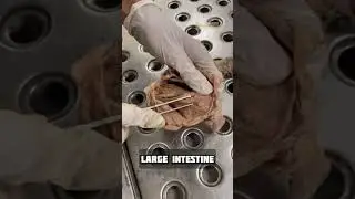 Large Intestine 1 #14 | Anatomy Abdomen and Pelvis | #mbbs #neet #viral #shorts #shortfeed