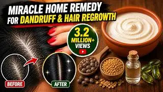 Miracle Home Remedy For Dandruff & Hair Regrowth | Sushmita's Diaries