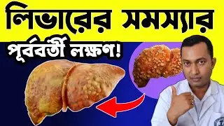 লিভারের সমস্যার শুরুর দিকে সাতটি লক্ষণ | লিভারের সমস্যা থেকে মুক্তির উপায় | Fatty liver