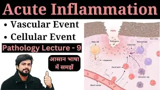 Acute Inflammation - Vascular and Cellular Event | Pathology Lecture in Hindi | Nursing | Pharmacy