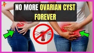 💪💪 Ovarian Cyst - How to be healthy 💪💪