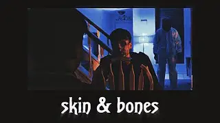skin & bones