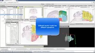 Pubanatomy 3D How to manipulate Gene ISH Section Images
