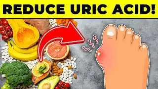 Top 8 Foods That Reduce Uric Acid Levels Naturally