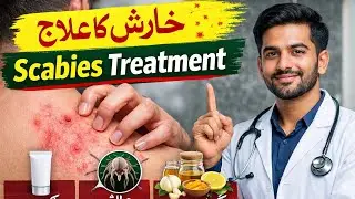 Scabies Treatment in urdu hindi||kharish ka ilaaj|خارش کا علاج