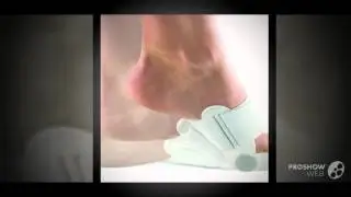 отклонение большого пальца стопы кнаружи

  - Уникальный фиксатор Valgus Pro