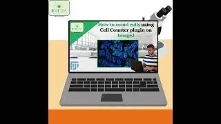 How to count cells using ImageJ Cell Counter #plugin #cell #counter #imagej #shorts #science