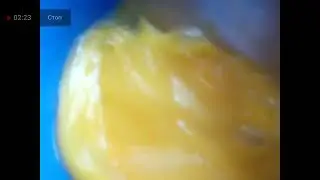 СРОЧНО!! ОТ САМЫХ СТРАШНЫХ ДИАГНОЗОВ! ПОЧЕМУ ЭТИ ПРОДУКТЫ ТЕРМИЧЕСКИ ПОЛЕЗНЫ, ЗА 2 МИН 19. 07.2024