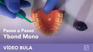 Passo a Passo: Restaurações diretas com o uso do adesivo de 2 passos Ybond Mono - Yller