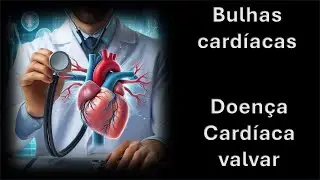 Bulhas e valvulopatias cardíacas