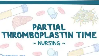 Coagulation | Partial Thromboplastin Time PTT | Nursing | osomosis |