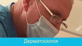 Дерматоскопия - метод проверки новообразований на коже