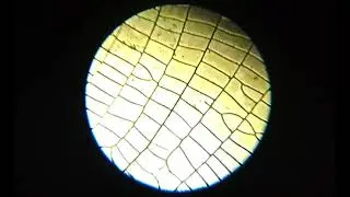 Cell Phone Adapter for Microscope Test#1
