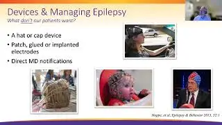 Wearable Technology for Brain Diseases | Webinar
