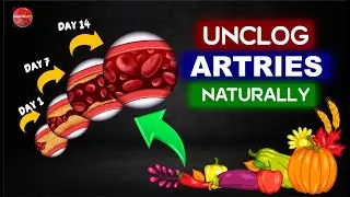7 Proven Ways To Follow This Week To Unclog Your Arteries In 7 Days