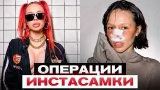 ПЛАСТИЧЕСКИЕ ОПЕРАЦИИ ИНСТАСАМКИ - Какие у них ПОСЛЕДСТВИЯ?