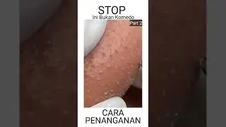 STOP INI BUKAN KOMEDO!! Part2