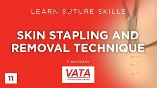 Skin Stapling and Removal Technique - Learn Suture Techniques - VATA