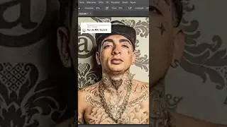 Mc Guimê tendo as tatuagens removidas 