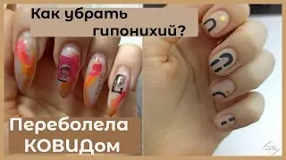 ПЕРЕБОЛЕЛА КОВИДом/Как убрать разросшийся гипонихий?Сам себе мастер