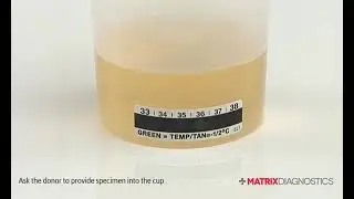 Matrix Diagnostics - How to Use Your Urine Back to Lab Test