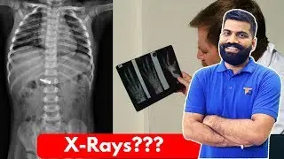 X-Rays.. The Powerful Waves? X-Rays Explained!!!