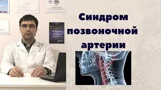 Синдром позвоночной артерии
