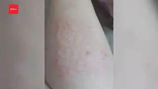 На маркетплейсах продают липолитики - это опасно?